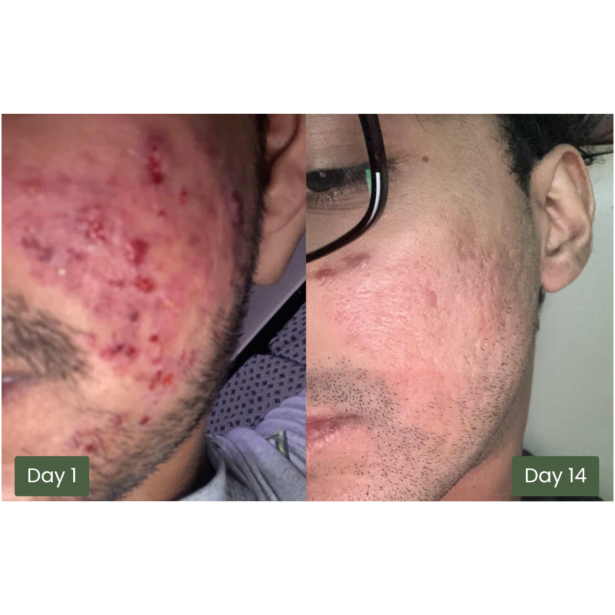 Detox Powder for Skin, Gut & Hormone